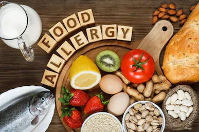 Food Allergies