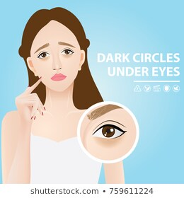 Dark Circles